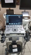 CHISON SonoAir 70 Portable Laptop Ultrasound