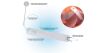 MEDIFLEX VBN10X05 Versa Lifter Band - Port-Free Internal Retractor 6.5cm needle Sterile, Box of 5