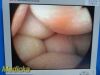 R. WOLF 8934.441 PANOVIEW 10mmx0° Lumina SL Rigid Telescope, Laparoscope