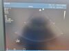 PHILIPS S8-3 Ultrasound Transducer