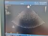 PHILIPS S3-1 Ultrasound Transducer