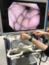 OLYMPUS CV 180 , CLV 180 with 2 scopes GIF H 180J ,CF type H180DL and new Pig Tail endoscopy system
