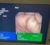 OLYMPUS GIF-XP160 Gastroscope