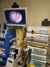 FUJINON EB-470S Bronchoscope