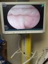 FUJINON EC-590WL Colonoscope