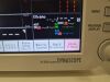 FUKUDA DENSHI DS 8500 Dynascope Anesthesia Monitor