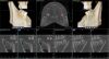 VATECH Pax I 3D Smart Plus Dental CT