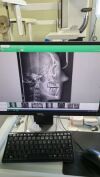 VATECH PAX I 3D SMART Dental CT