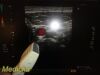 TOSHIBA 2012  PLT-604AT Linear Array Ultrasound Transducer