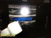 TOSHIBA 2012  PLT-604AT Linear Array Ultrasound Transducer