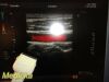 TOSHIBA 2012  PLT-604AT Linear Array Ultrasound Transducer