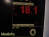 FUKUDA DENSHI DS-7200 Touchscreen Patient Monitor
