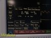 FUKUDA DENSHI DS-7200 Touchscreen Patient Monitor