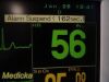 FUKUDA DENSHI DS-7200 Touchscreen Patient Monitor
