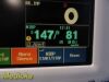 FUKUDA DENSHI DS-7200 Touchscreen Patient Monitor