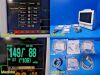 FUKUDA DENSHI 2014  DS7200 Touchscreen Patient Monitor