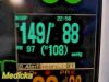 FUKUDA DENSHI 2014  DS7200 Touchscreen Patient Monitor