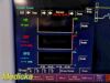 FUKUDA DENSHI 2015  Patient Monitor