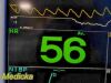 FUKUDA DENSHI 2015  Patient Monitor