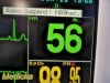 FUKUDA DENSHI 2010  DS7200 Patient Monitor