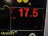 FUKUDA DENSHI 2010  DS7200 Patient Monitor