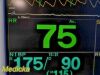 FUKUDA DENSHI 2010  DS-7200   W/ Patient Leads, NBP, SpO2, ECG, Temp ~ Monitor