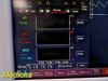 FUKUDA DENSHI 2010  DS-7200   W/ Patient Leads, NBP, SpO2, ECG, Temp ~ Monitor