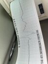 MEDTRONIC 20 Defibrillator