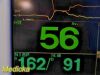 FUKUDA DENSHI DS7200 Touchscreen Patient Monitor