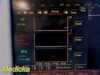 FUKUDA DENSHI DS7200 Touchscreen Patient Monitor