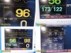 FUKUDA DENSHI DS-7200 Colored Touchscreen Patient Monitor