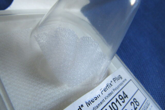 BARD Ref: 0112750 Mesh Perfix Plug Small Monofilament Knitted Polypropylene, Exp. 06/2021