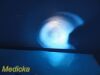 SMITH & NEPHEW 2009  DYONICS 7206084 Xenon Light Source