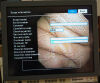 OLYMPUS GIF-N180 Gastroscope