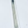 RICHARD WOLF 2280.331 Electrohydraulic Lithotriptor