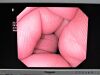 OLYMPUS SIFQ180 Enteroscope