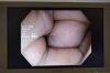 OLYMPUS PCF-H180AL Duodenoscope