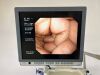 OLYMPUS CV-260SL complete Tower with GIF-H260 Gastro and CF-Q260DL Long Colonoscope Endoscope