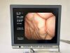 OLYMPUS CV-260SL complete Tower with GIF-H260 Gastro and CF-Q260DL Long Colonoscope Endoscope