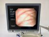 OLYMPUS CV-260SL complete Tower with GIF-H260 Gastro and CF-Q260DL Long Colonoscope Endoscope