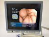 OLYMPUS CV-260SL complete Tower with GIF-H260 Gastro and CF-Q260DL Long Colonoscope Endoscope