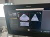 PHILIPS X6-1 Ultrasound Transducer