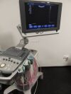 SIEMENS Acuson X 300 PE Ultrasound - OB / GYN