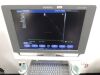 SIEMENS Acuson X 300 PE Ultrasound - OB / GYN