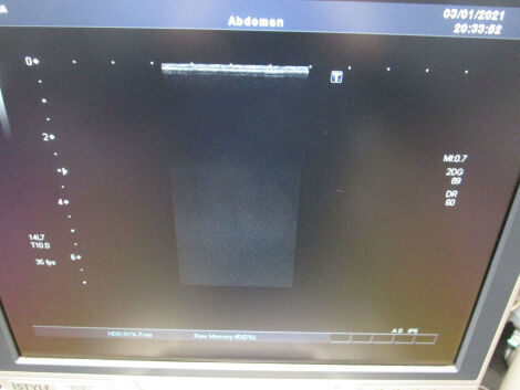 TOSHIBA PLT1204AT Ultrasound Transducer