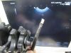 PENTAX EG-387UTK Gastroscope