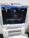KONTRON Medical KM60 MyLab 60 Ultrasound scanner