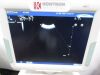KONTRON Medical KM60 MyLab 60 Ultrasound scanner