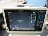 INVIVO Expression MRI MRI Mobile