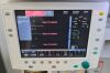 GE DATEX-OHMEDA Avance Full Set with B850 Monitor and Modules Anesthesia Machine